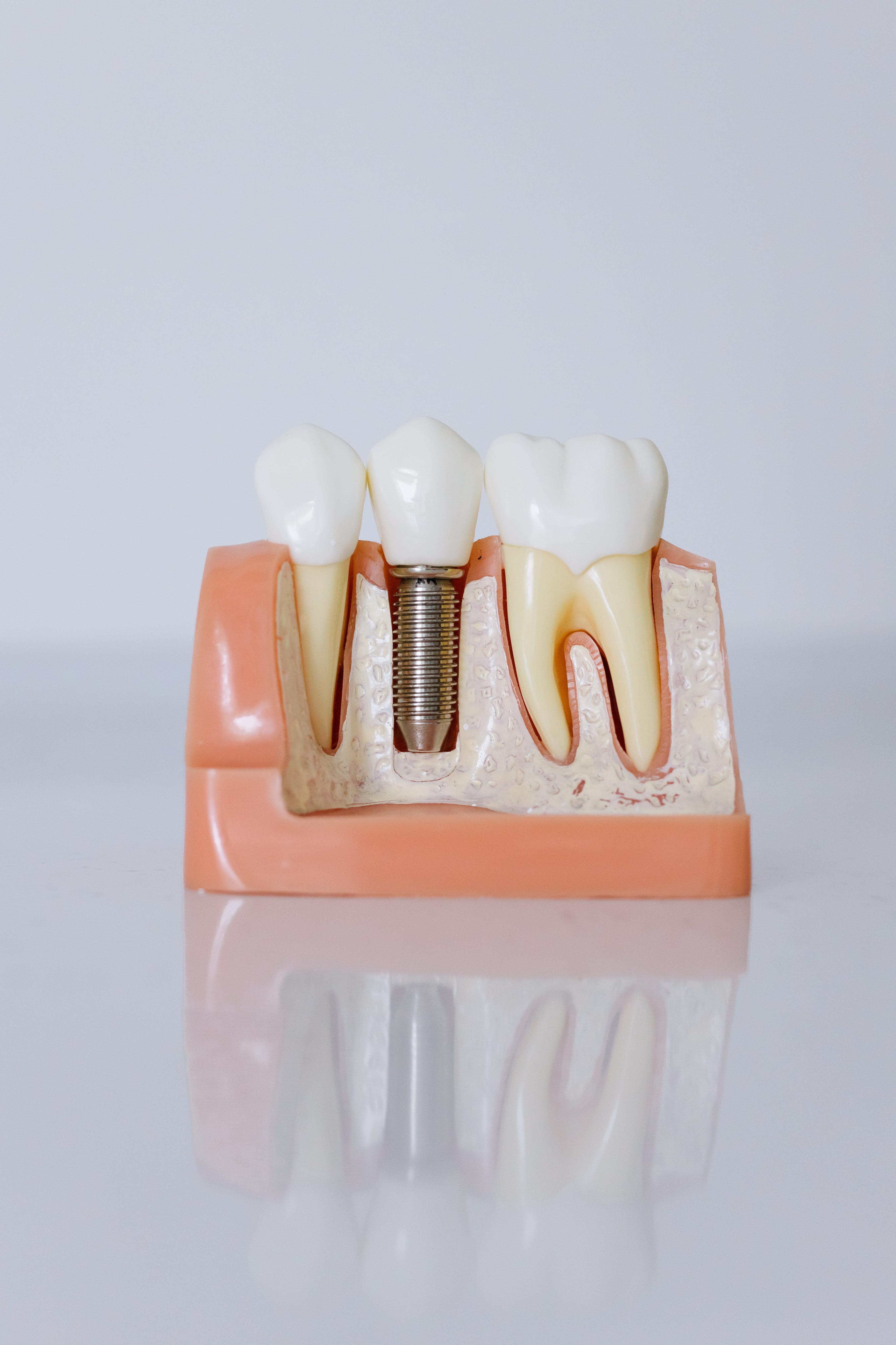 Implantologie image 3