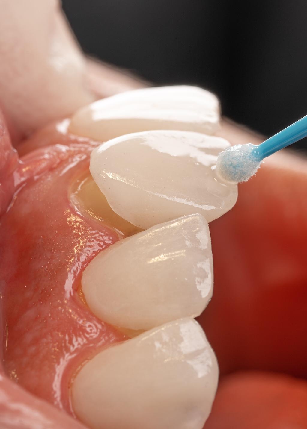 Estetică și Protetică Dentară