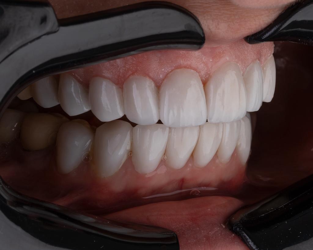 Estetică și Protetică Dentară image 1