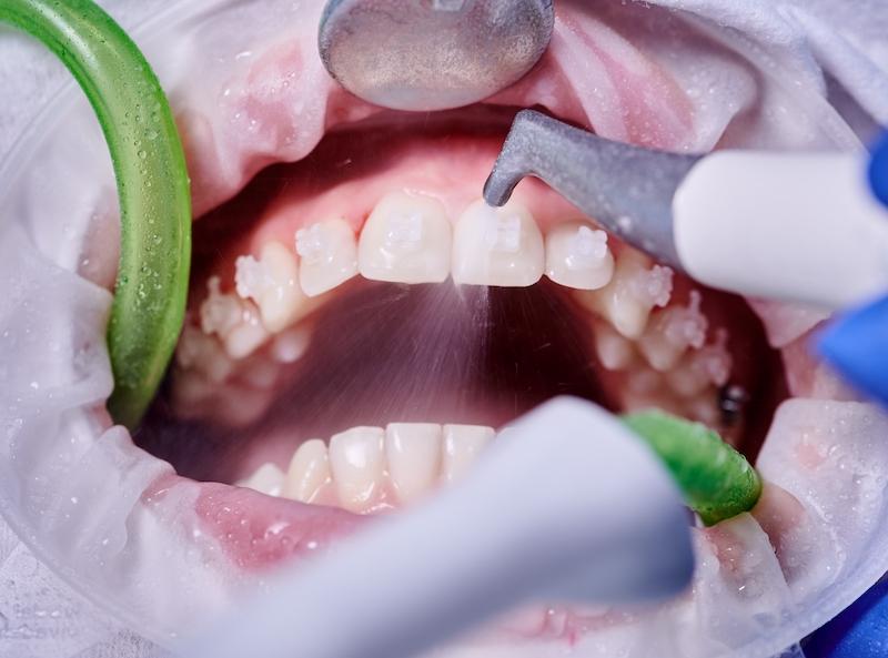 Odontoterapie image 1