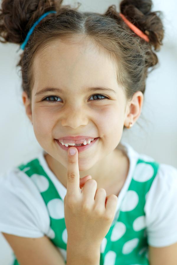 Pedodonție image 2