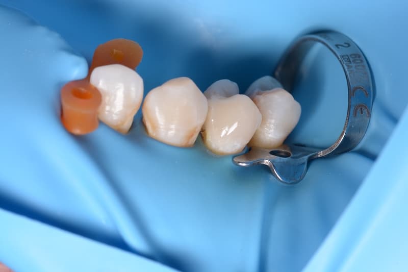 Odontoterapie image 2