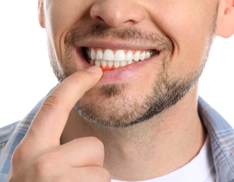 Parodontologie image 1